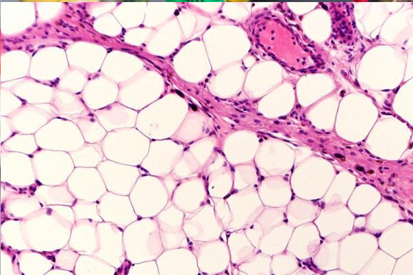 Can Weight Loss Drugs Affect Your Fertility? A Woman��s Guide